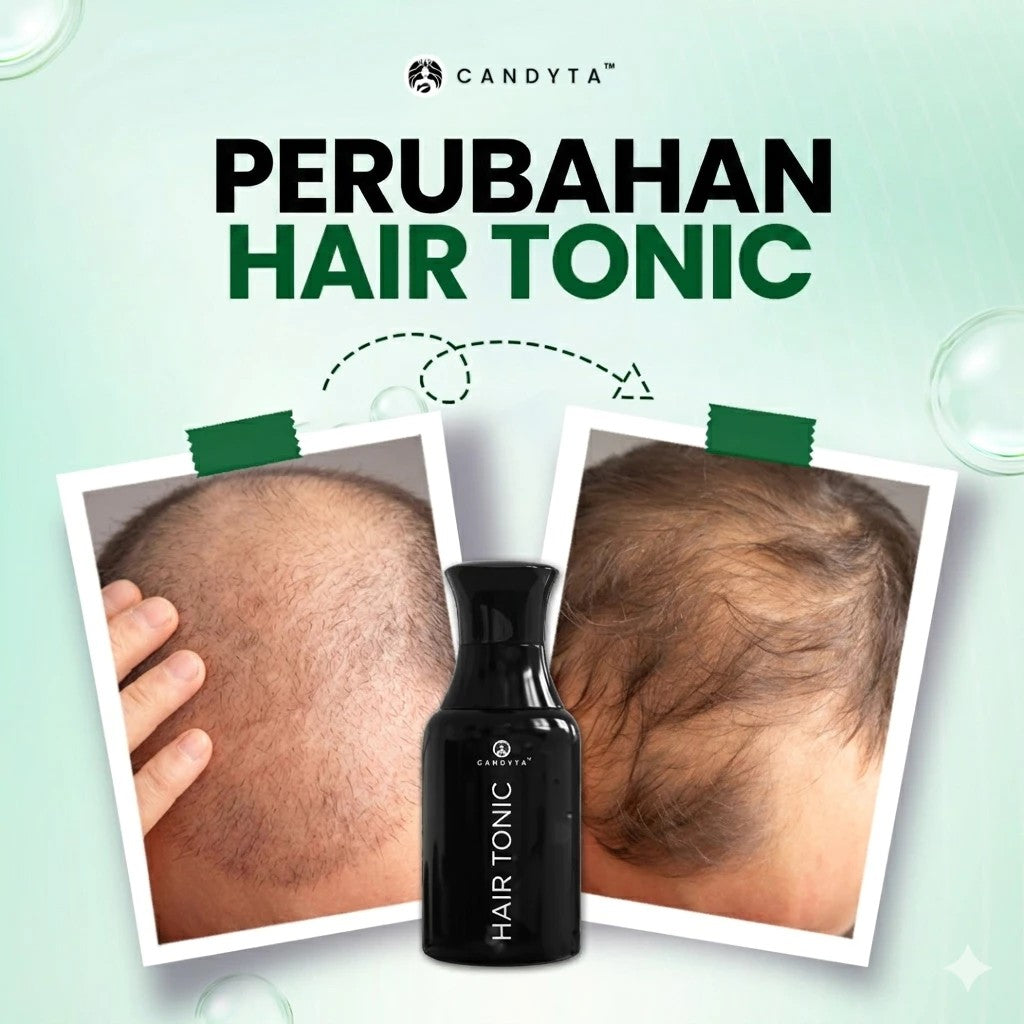 Hair Tonic 30ML